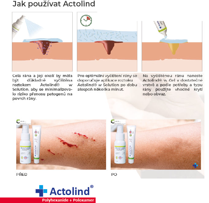 Antimikrobiální výplach pro čištění, zvlhčení a péči o rány, Actolind® w Solution