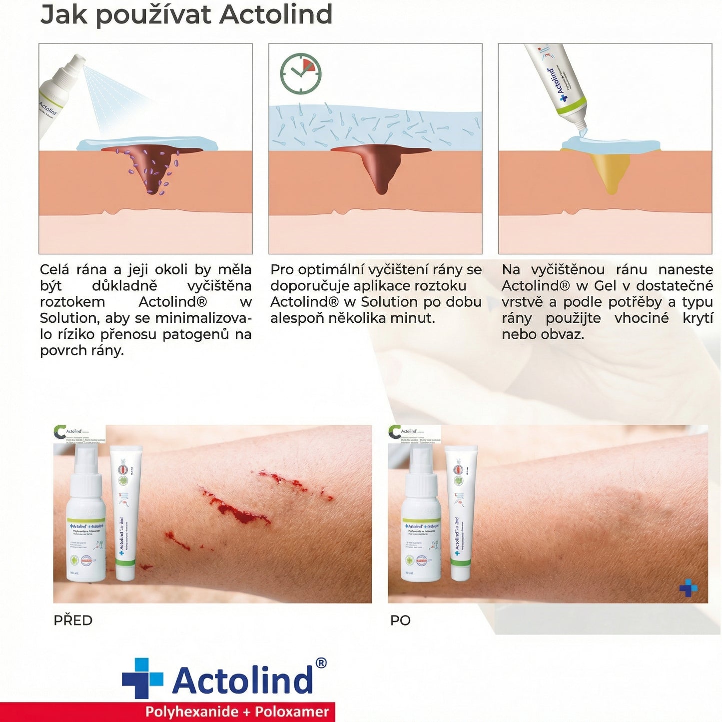 Actolind® w Solution, 500ml