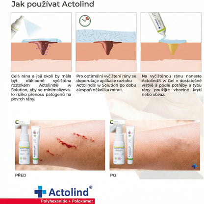 Actolind® w Solution, 500ml
